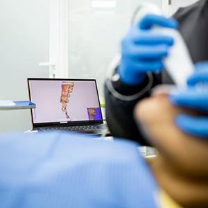 Dentist using a digital impression system with monitor showing patient’s teeth in the background