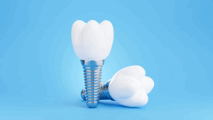 Two dental implants on a bright blue background