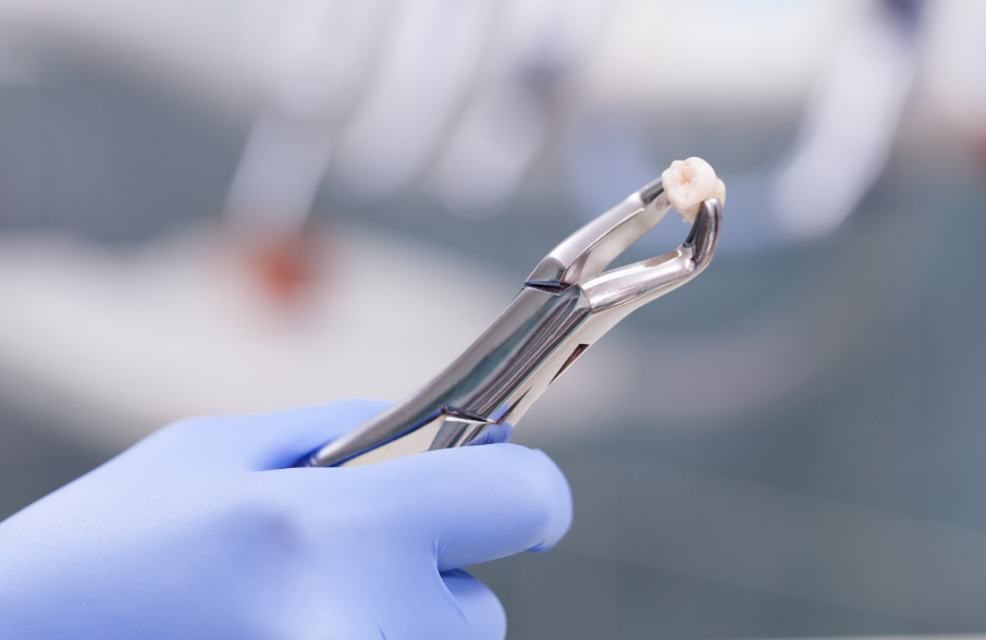 Extracted tooth on forceps